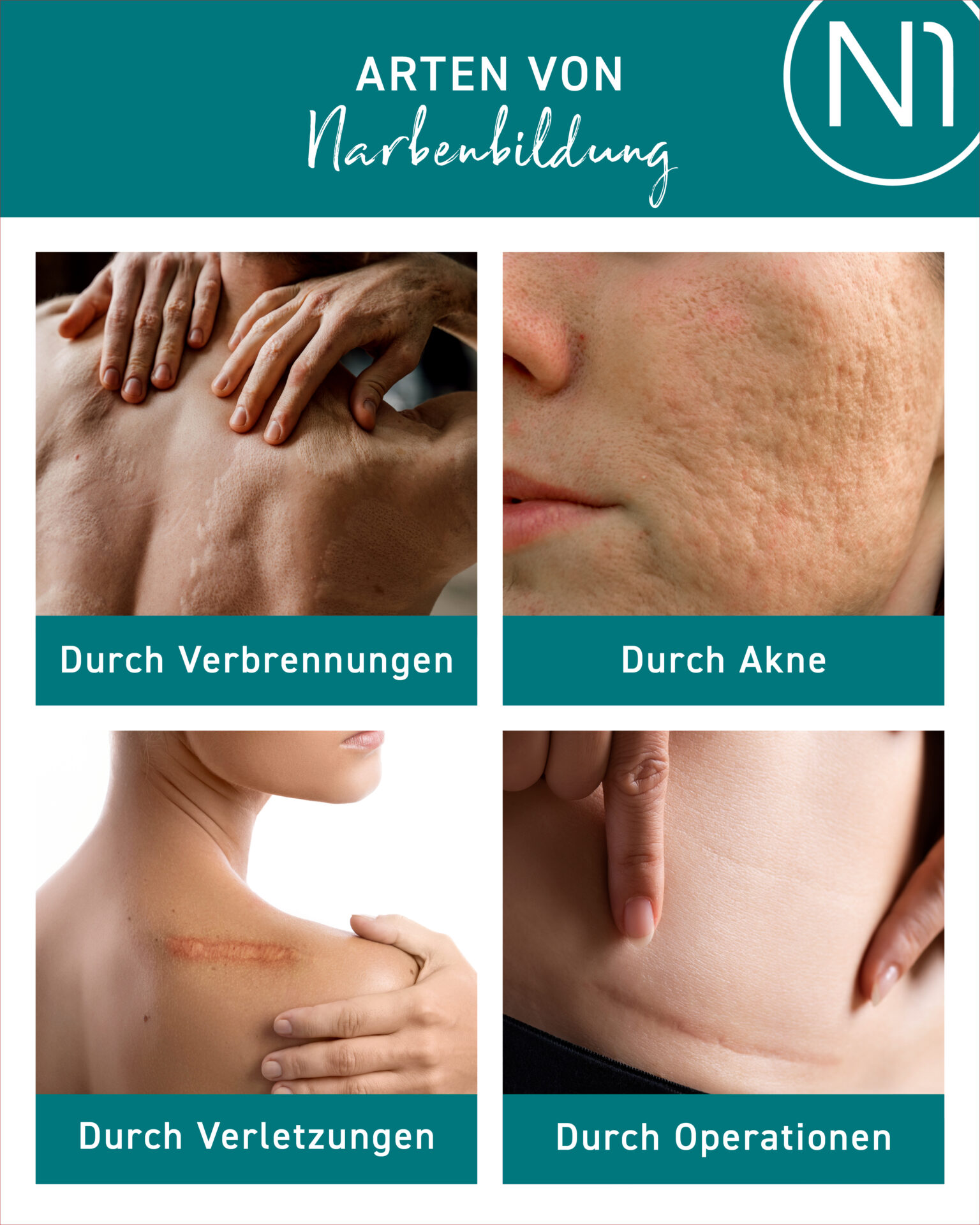 N1 NARBEN GEL – Produktbild 3
