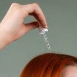 scalp psoriasis