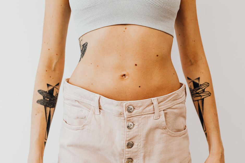 guttate psoriasis