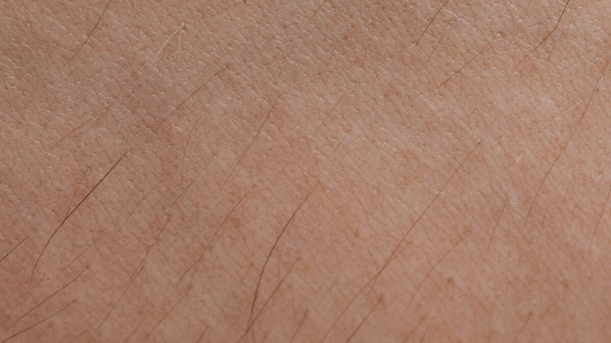 wie sieht nagelpilz aus