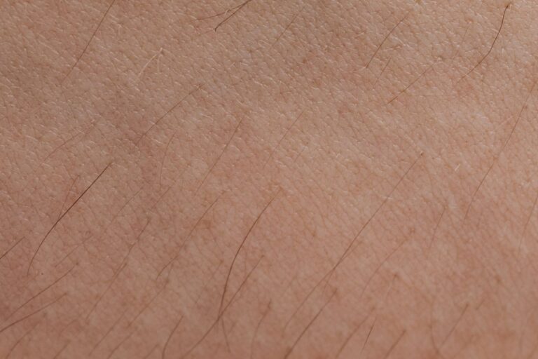 Wie sieht Nagelpilz aus? Anzeichen & Fotos erkennen