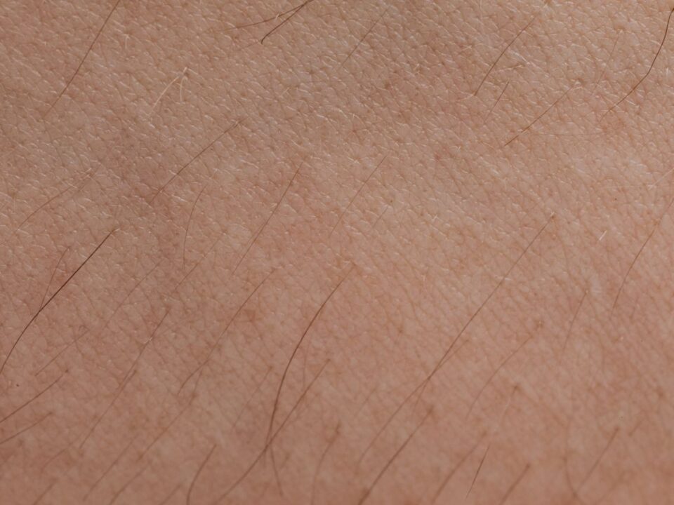 wie sieht nagelpilz aus