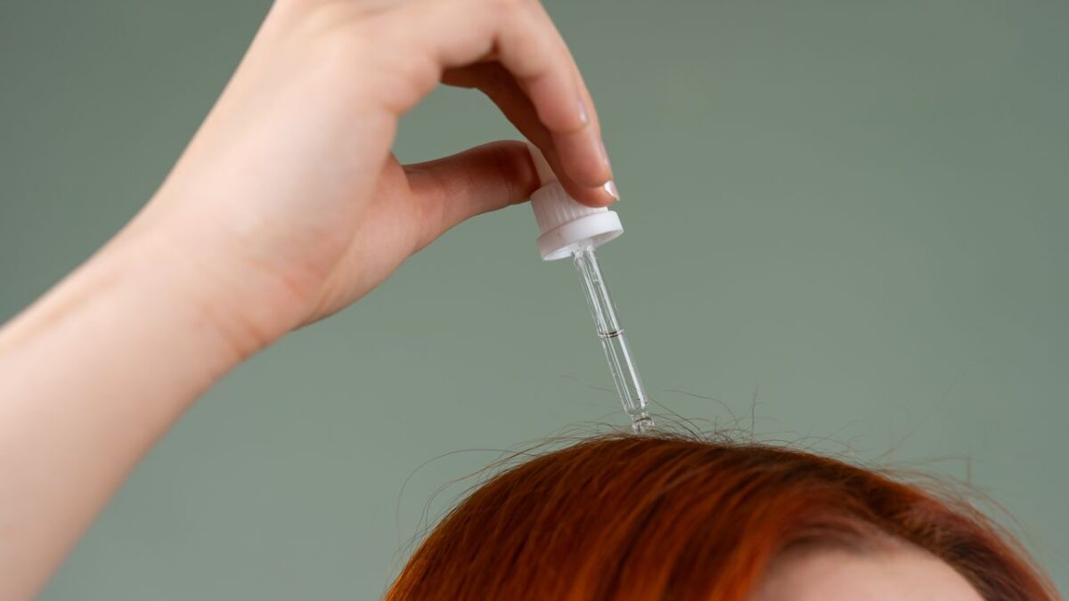 scalp psoriasis